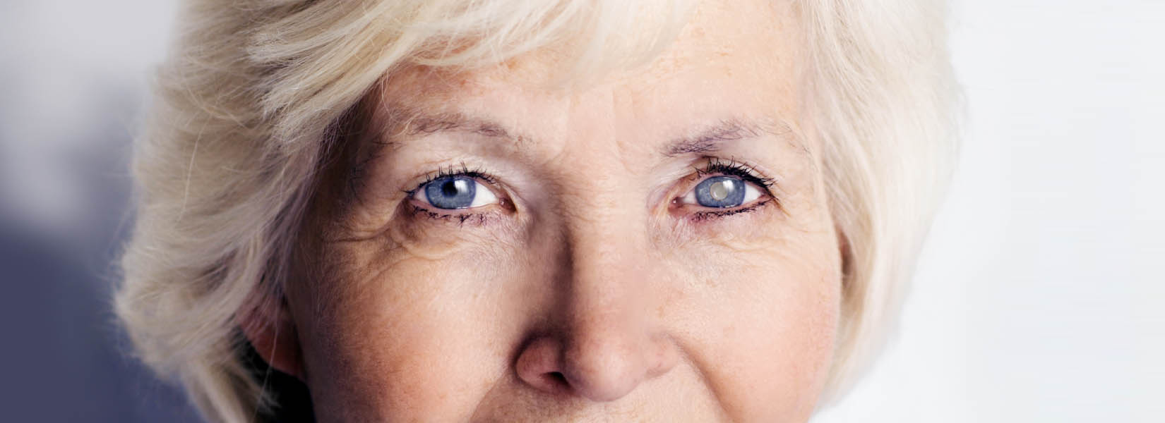 Cataract Surgery in Lee's Summit